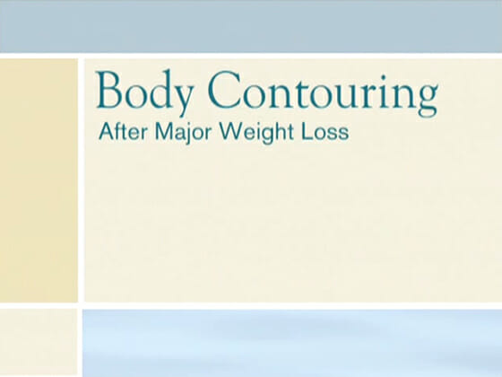 Body Contouring after Weight Loss<br />14 min 54 sec