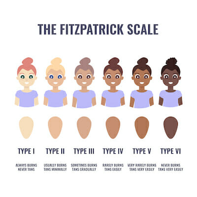 Illustrated Fitzpatrick Scale showing different skin tones and how they react to sun exposure